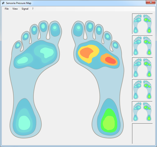 Sensoria Developer Kit: a Great Way of Contributing to the Quantified Self & NUI Movements